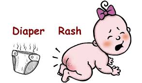 diaper rash cause and remedies