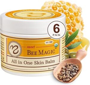 natural-baby-lotions-for-eczema-relief